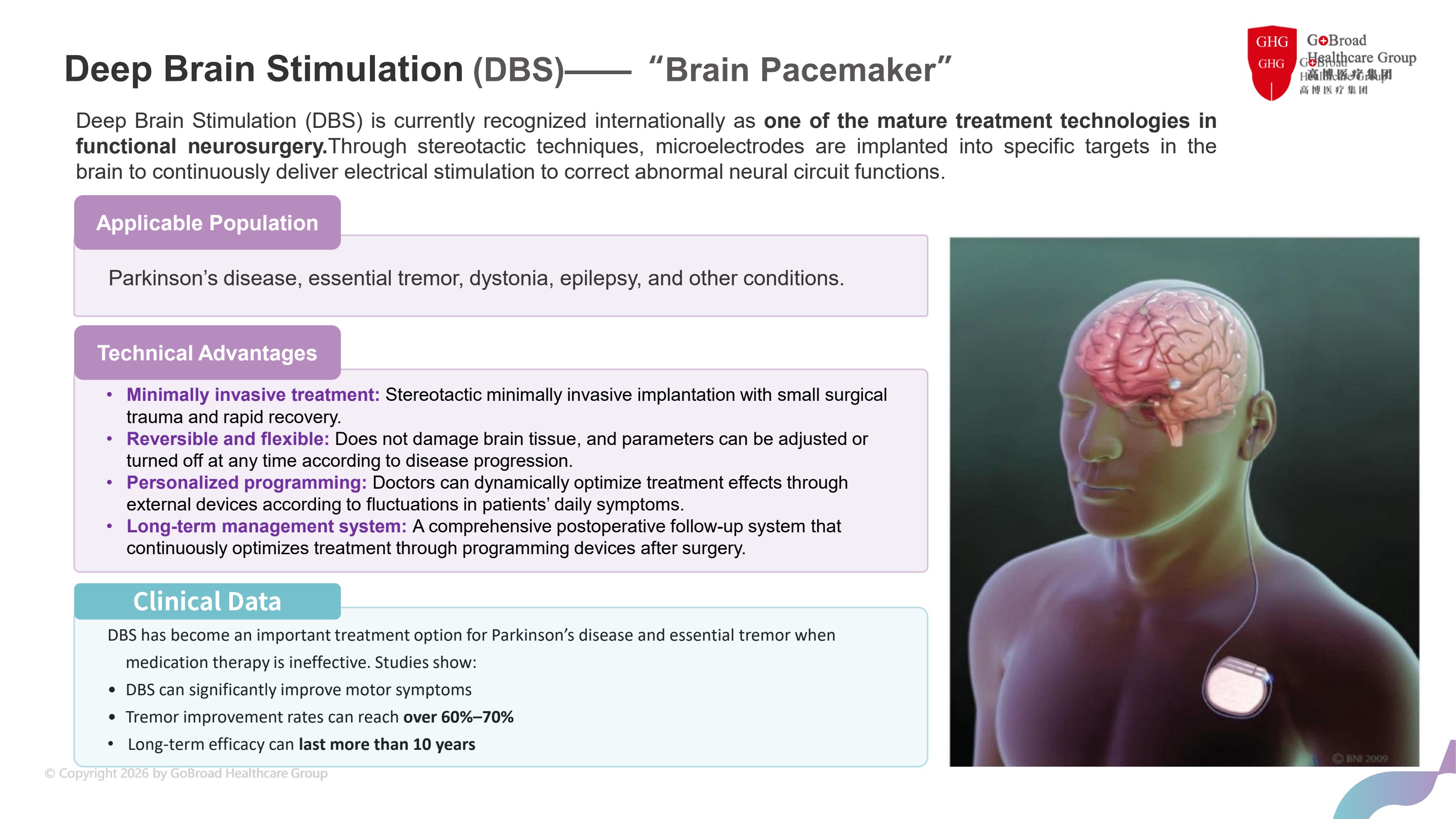 Deep Brain Stimulation diagram — implanted brain pacemaker system