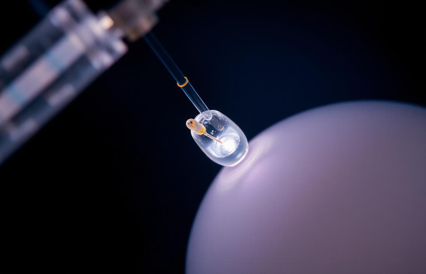 ICSI micro-injection of a single sperm into an egg