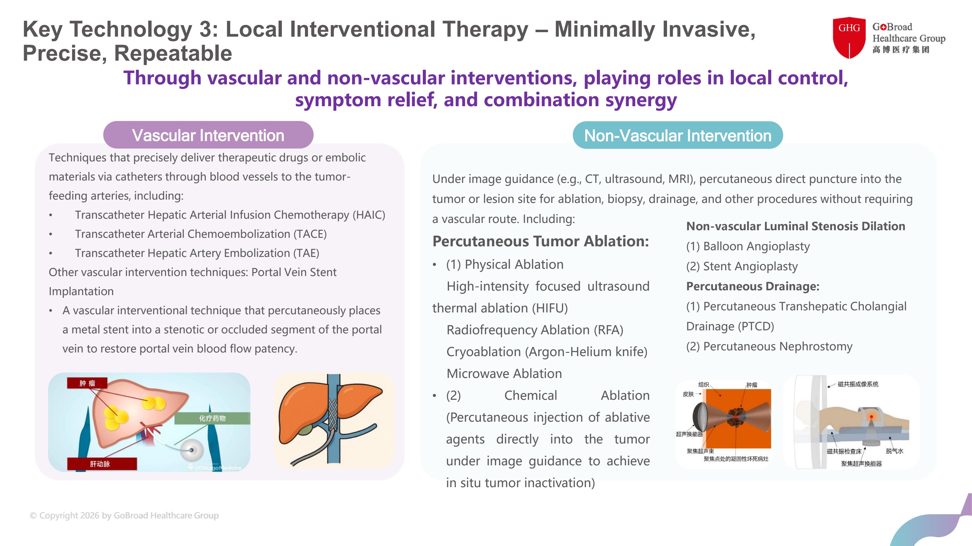 Local Interventional Therapy · Minimally Invasive, Precise, Repeatable